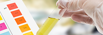 16692_chromatography Chromatography