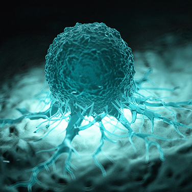 Tumor